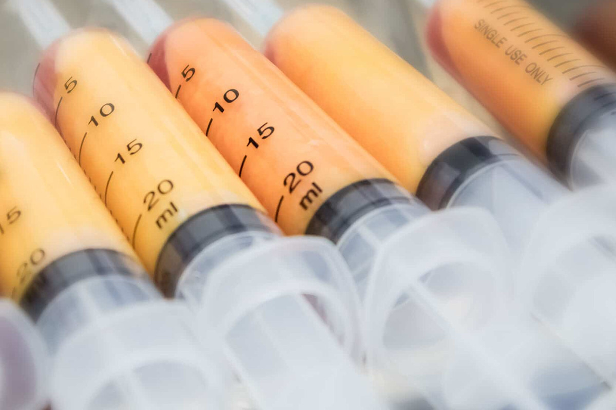 Lopofilling para el pene